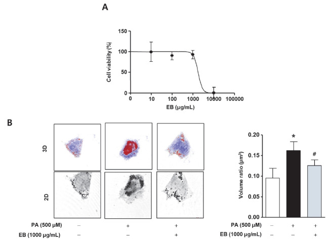 A sport supplement candidate of Erigeron breviscapus extract regulates lipogenesis in vitro and in vivo.