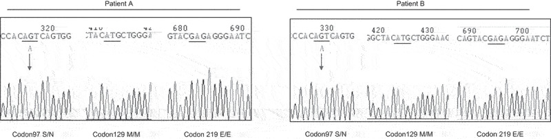 Two Chinese patients of sporadic Creutzfeldt-Jacob disease with a S97N mutation in <i>PRNP</i> gene.