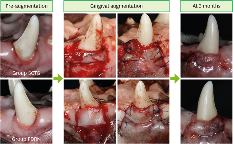 Effect of polydeoxyribonucleotide with xenogeneic collagen matrix on gingival phenotype modification: a pilot preclinical study.