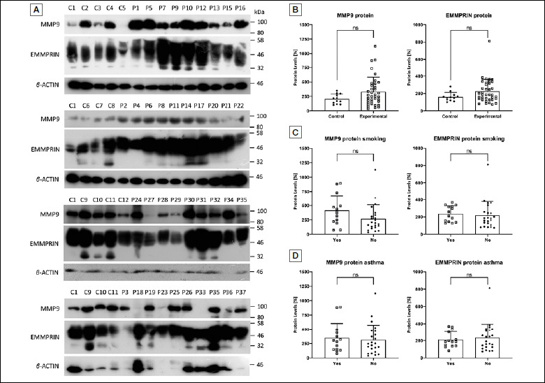 Expression profiles of MMP-9 and EMMPRIN in chronic rhinosinusitis with nasal polyps.
