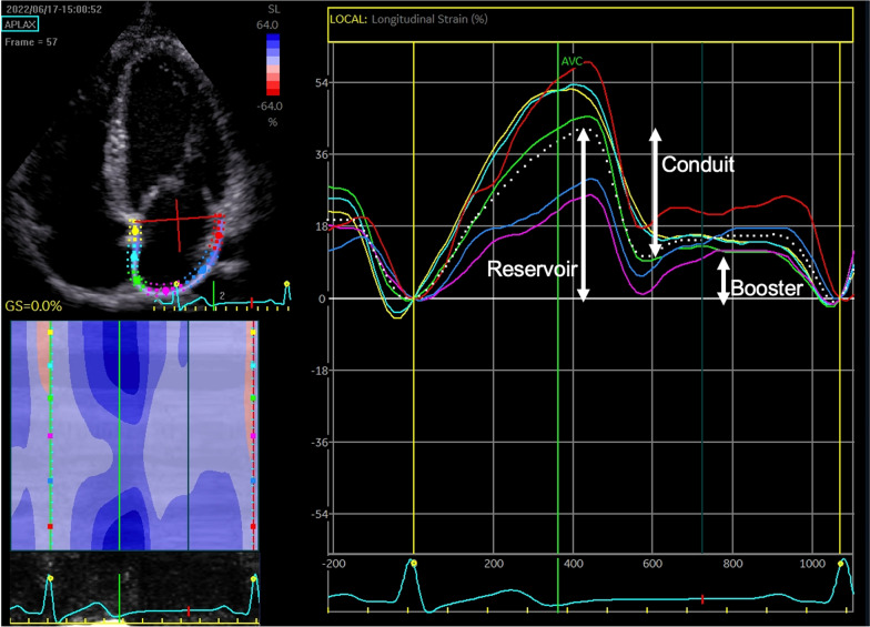 The impact of image and performance enhancing drugs on atrial structure and function in resistance trained individuals.