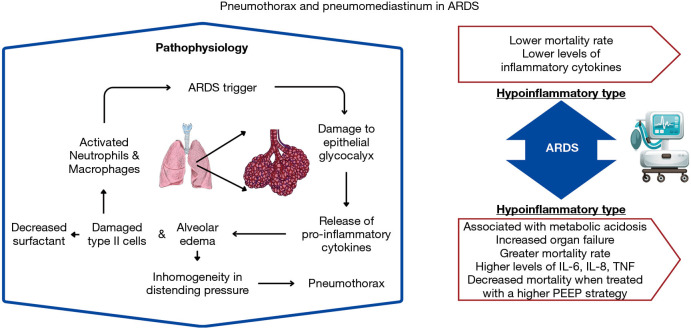 Pneumomediastinum and pneumothorax in acute respiratory distress syndrome (ARDS) patients: a narrative review.