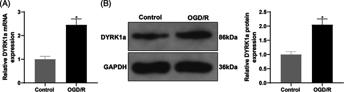 Mechanism of DYRK1a in myocardial ischemia-reperfusion injury by regulating ferroptosis of cardiomyocytes.