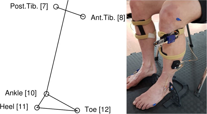 Effects of foot and ankle mobilisations combined with home stretches in people with diabetic peripheral neuropathy: a proof-of-concept RCT.