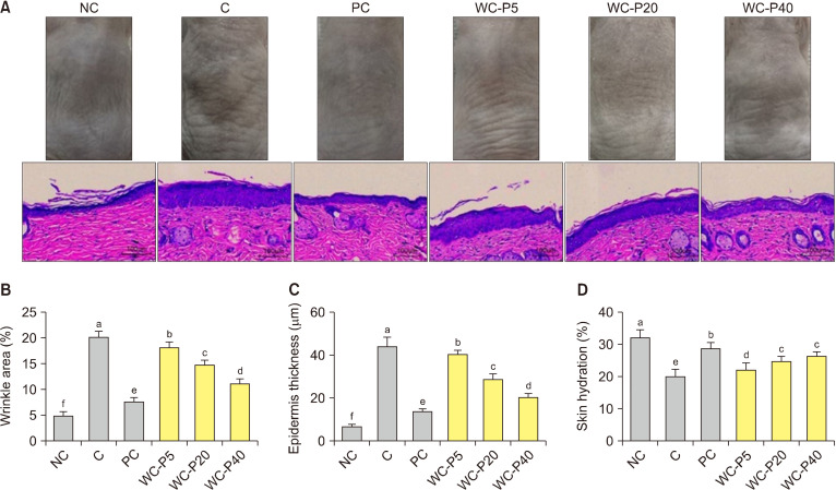 Wheat Ceramide Powder Mitigates Ultraviolet B-Induced Oxidative Stress and Photoaging by Inhibiting Collagen Proteolysis and Promoting Collagen Synthesis in Hairless Mice.