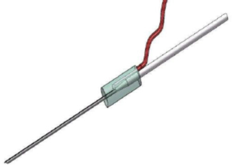 Smart needle electrical bioimpedance to provide information on needle tip relationship to target nerve prior to local anesthetic deposition in peripheral nerve block (USgPNB) procedures.