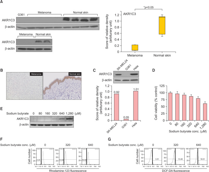 Upregulation of AKR1C3 in Sodium Butyrate Treated G361 Cell.