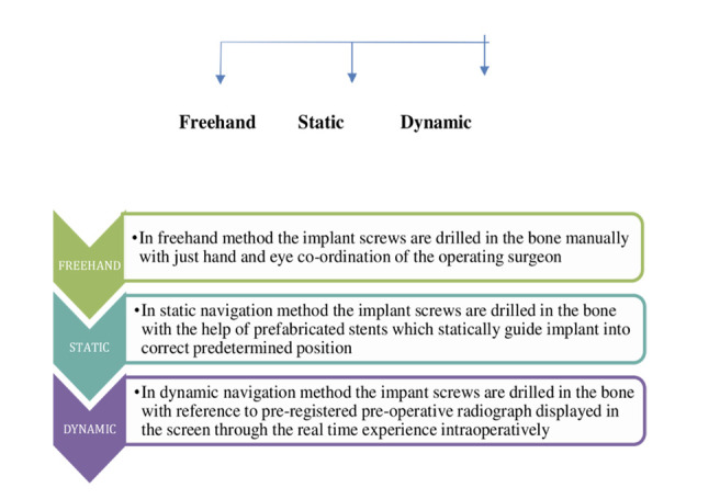 Dynamic Navigation in Dental Implantology.