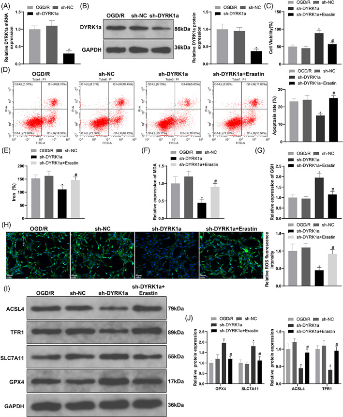 Mechanism of DYRK1a in myocardial ischemia-reperfusion injury by regulating ferroptosis of cardiomyocytes.