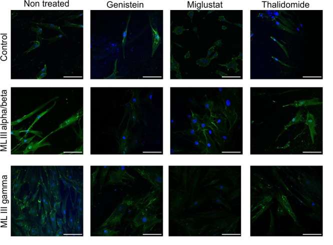 In vitro substrate reduction, chaperone and immunomodulation treatments reduce heparan sulfate in mucolipidosis III human fibroblasts.