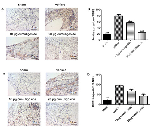 Curculigoside inhibits osteoarthritis <em>via</em> the regulation of NLRP3 pathway.