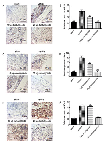 Curculigoside inhibits osteoarthritis <em>via</em> the regulation of NLRP3 pathway.