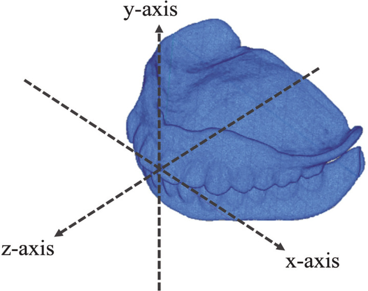 Prediction accuracy of incisal points in determining occlusal plane of digital complete dentures.