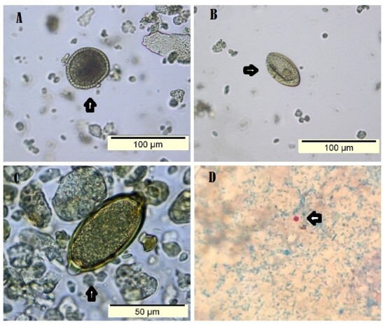 Endoparasites of <i>Leopardus pardalis</i> (Carnivora, Felidae) rescued in the State of Rio de Janeiro.