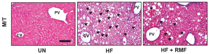 Rosae multiflorae fructus regulates the lipogenesis in high-fat diet-induced NAFLD mice model.