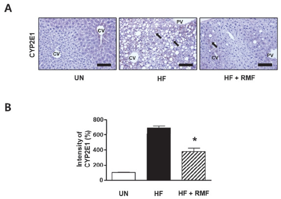Rosae multiflorae fructus regulates the lipogenesis in high-fat diet-induced NAFLD mice model.