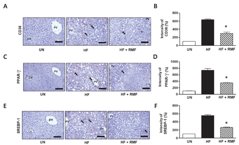 Rosae multiflorae fructus regulates the lipogenesis in high-fat diet-induced NAFLD mice model.