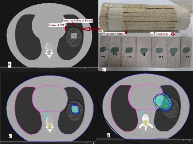Evaluation of Radiation Treatment Planning Algorithms in IMRT and VMAT: A Comparative Dosimetric Study in Lung Equivalent Heterogeneous Medium.