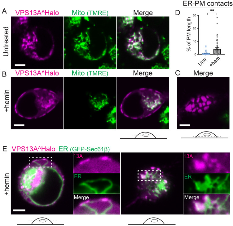 Erythroid Differentiation Dependent Interaction of VPS13A with XK at the Plasma Membrane of K562 Cells.