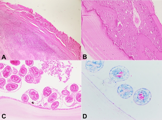 Ovarian hydatid cyst: an uncommon site of presentation.