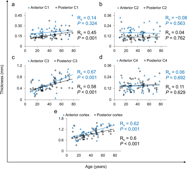 Age-related changes in geometry and transparency of human crystalline lens revealed by optical signal discontinuity zones in swept-source OCT images.