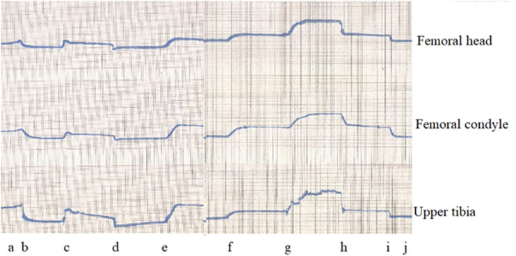 Hydraulic Joint Function and Osteoarthritis.