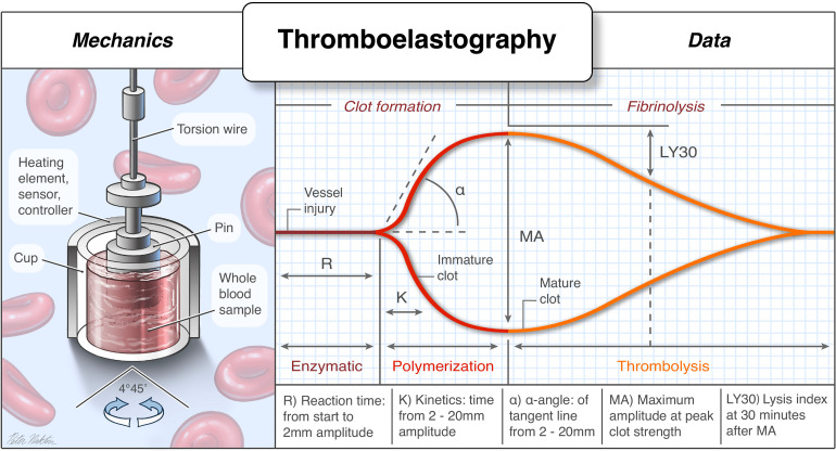 Review of Thromboelastography (TEG): Medical and Surgical Applications.