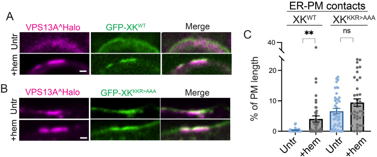 Erythroid Differentiation Dependent Interaction of VPS13A with XK at the Plasma Membrane of K562 Cells.