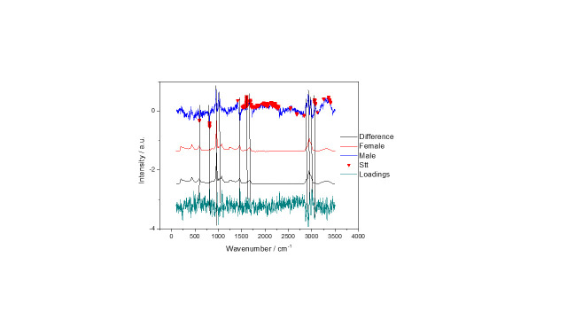 Age Estimation and Sex Determination Using Raman Spectra of Human Dentine.
