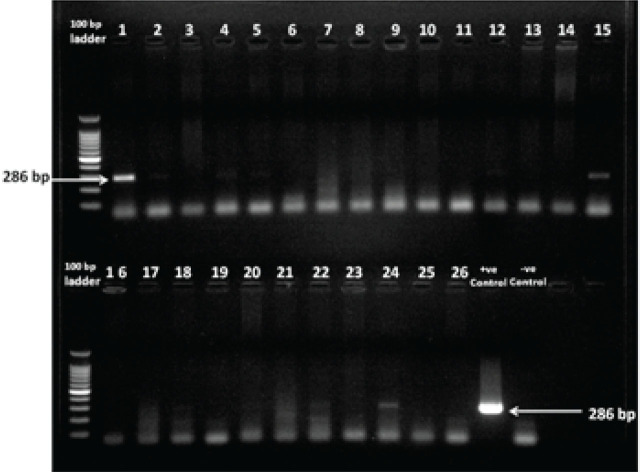 Serological and molecular detection of neurocysticercosis among epileptic patients in Nagpur, Maharashtra state (India).