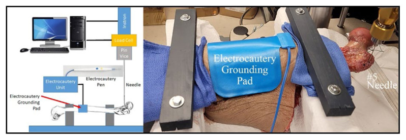 Use of Electrocautery to Facilitate Suture Passage Through the Greater Trochanter of the Femur: A Biomechanical Study.