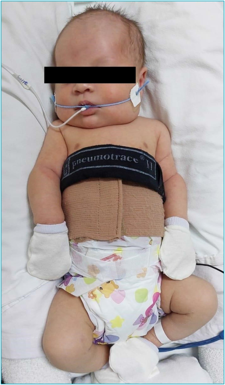 Real-time changes in rib cage expansion and use of abdominal mechanical stimulation in newborns: a quasi-experimental study.