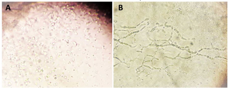 Clinic-mycological spectrum of <i>Candida</i> infection in diabetic foot ulcers in a tertiary care hospital.
