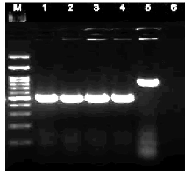 Clinic-mycological spectrum of <i>Candida</i> infection in diabetic foot ulcers in a tertiary care hospital.