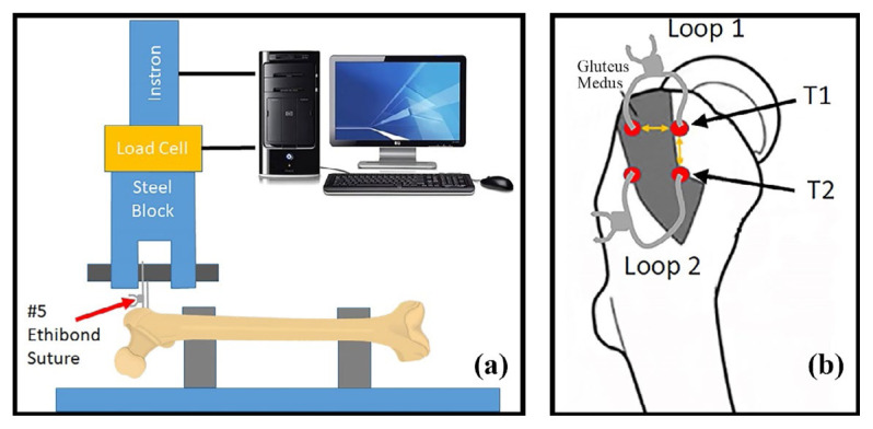 Use of Electrocautery to Facilitate Suture Passage Through the Greater Trochanter of the Femur: A Biomechanical Study.