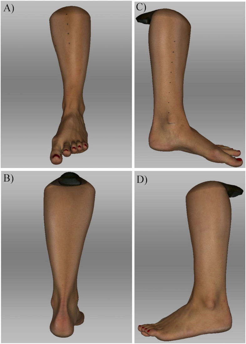 Establishing regions of interest of the lower leg and ankle for perioperative volumetric assessment with a portable 3D scanner in orthopedic and trauma surgery - a pilot study.