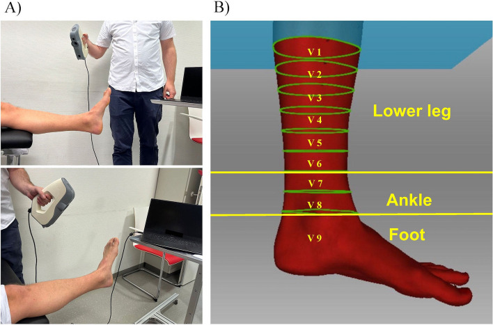 Establishing regions of interest of the lower leg and ankle for perioperative volumetric assessment with a portable 3D scanner in orthopedic and trauma surgery - a pilot study.