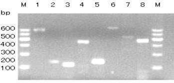 Polymorphism and expression of <i>GLUD1</i> in relation to reproductive performance in Jining Grey goats.