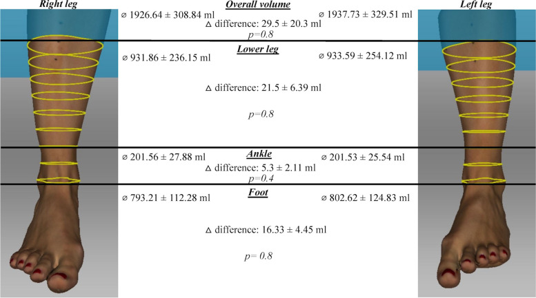 Establishing regions of interest of the lower leg and ankle for perioperative volumetric assessment with a portable 3D scanner in orthopedic and trauma surgery - a pilot study.