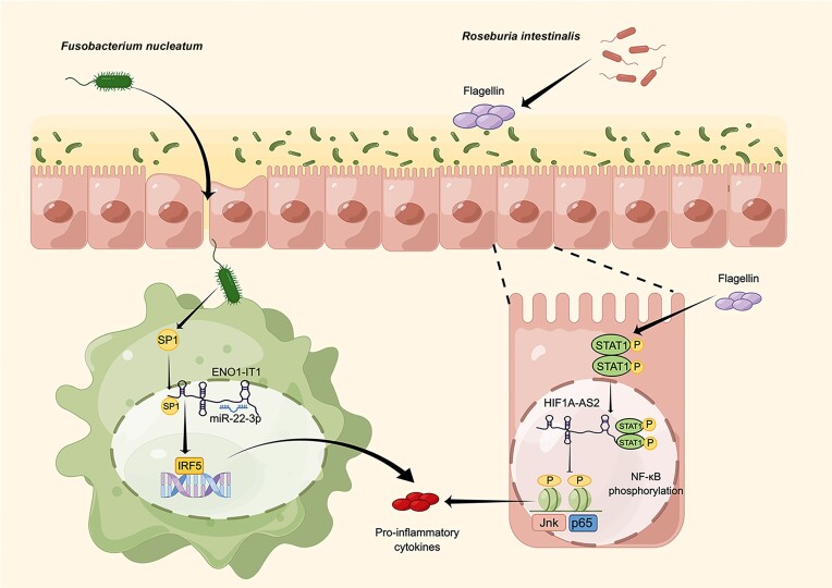 The significance of long non-coding RNAs in the pathogenesis, diagnosis and treatment of inflammatory bowel disease.