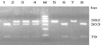 Polymorphism and expression of <i>GLUD1</i> in relation to reproductive performance in Jining Grey goats.