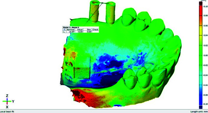Effect of Repeated Use of Different Types of Scan Bodies on Transfer Accuracy of Implant Position.