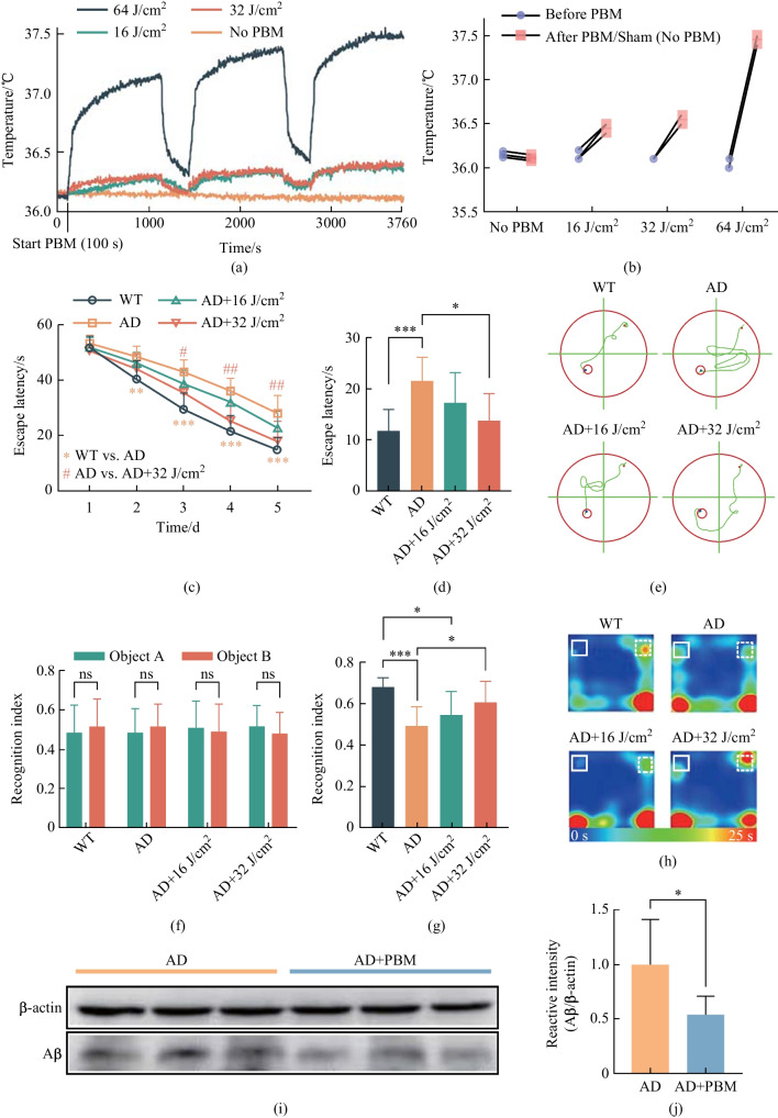 Photostimulation of lymphatic clearance of β-amyloid from mouse brain: a new strategy for the therapy of Alzheimer's disease.