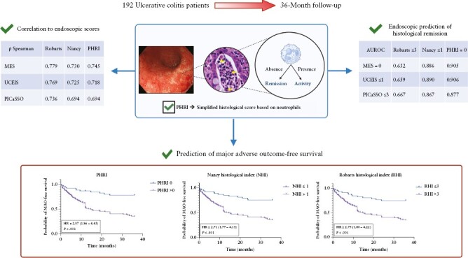 Neutrophil-only Histological Assessment of Ulcerative Colitis Correlates with Endoscopic Activity and Predicts Long-term Outcomes in a Multicentre Study.