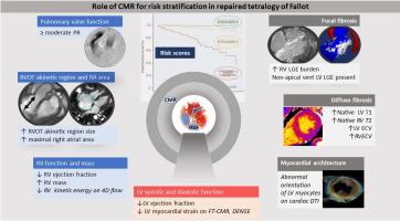 Use of Cardiovascular Magnetic Resonance for Risk Stratification in Repaired Tetralogy of Fallot