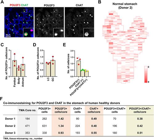 Dynamic tuft cell expansion during gastric metaplasia and dysplasia