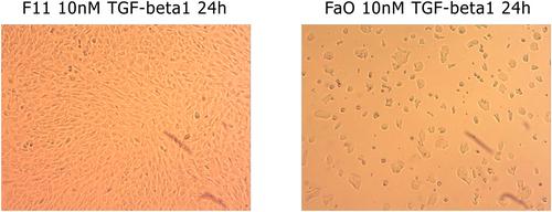 Assessment of the effectiveness of the peptide inhibitor homologous to the transforming growth factor β cytokine blocking the TGFβRI/TGFβRII receptor complex—pilot study