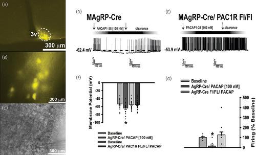 Dynamic, sex- and diet-specific pleiotropism in the PAC1 receptor-mediated regulation of arcuate proopiomelanocortin and Neuropeptide Y/Agouti related peptide neuronal excitability by anorexigenic ventromedial nucleus PACAP neurons