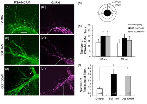 Somatostatin affects GnRH neuronal development and migration and stimulates olfactory-related fiber fasciculation