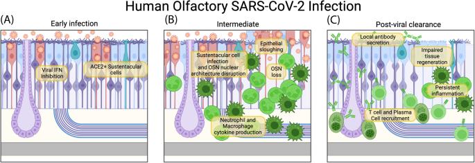 Olfactory immune response to SARS-CoV-2